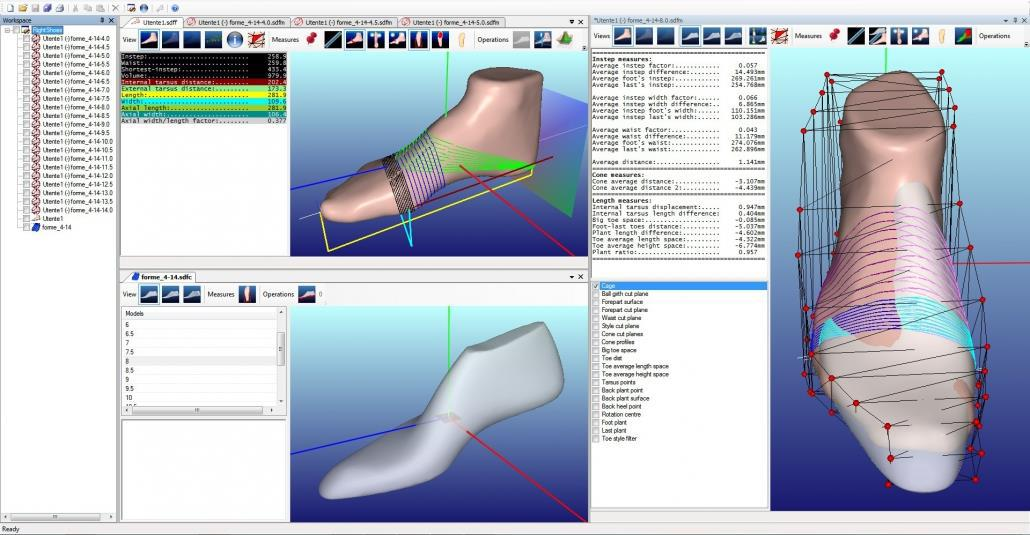 Study on the Effect of Three-dimensional Reconstruction Technique Based on Human Gait Plantar Transient Data on Rehabilitation of Patients with Abnormal Foot Arch