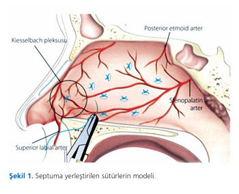 Comparison of postoperative mucociliary clearance times in patients who had undergone septoplasty with or without tampon application