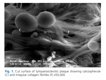 Analysis of tympanosclerotic plaques via atomic force microscope and scanning electron microscope