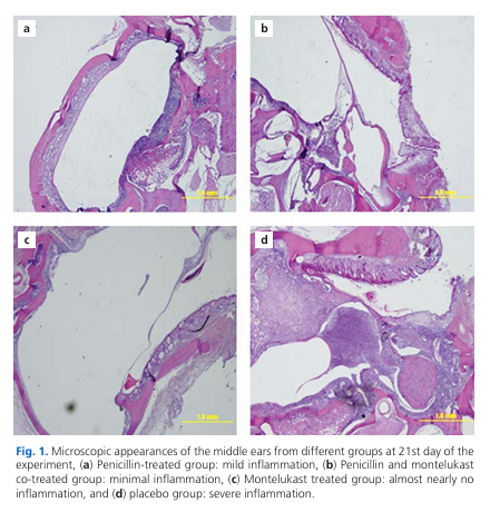 Effects of penicillin and montelukast sodium on middle ear mucosa in rats with experimental acute otitis media