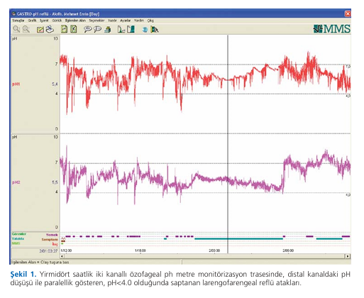 Results of 24-hour pH monitorization in laryngopharyngeal reflux cases presenting with various symptoms