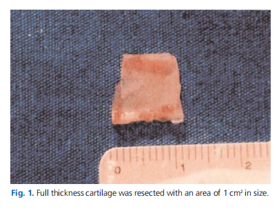 Investigation of the effects of fascia lata on neochondrogenesis in a rabbit model