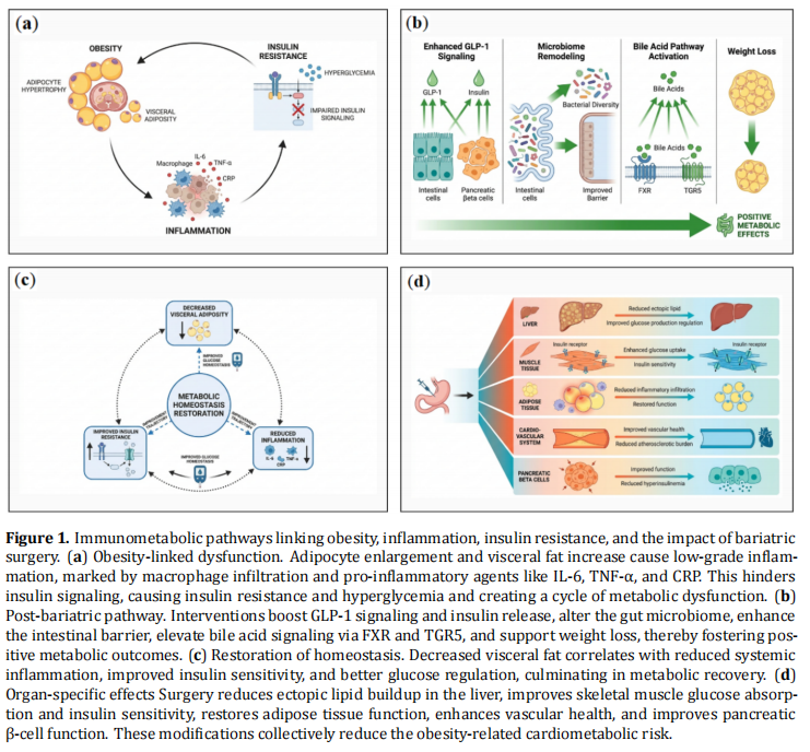 Bariatric Surgery as Immunometabolic Therapy: A Narrative Review of Mechanisms, Clinical Outcomes, and Future Precision Approaches