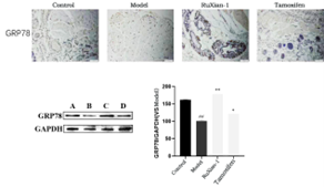 Traditional Mongolian medicine RuXian-1 suppress the breast hyperplasia by GRP78/PERK/CHOP pathway in rat model